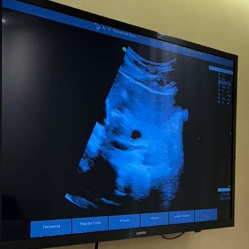 Ultrasonido abdominal